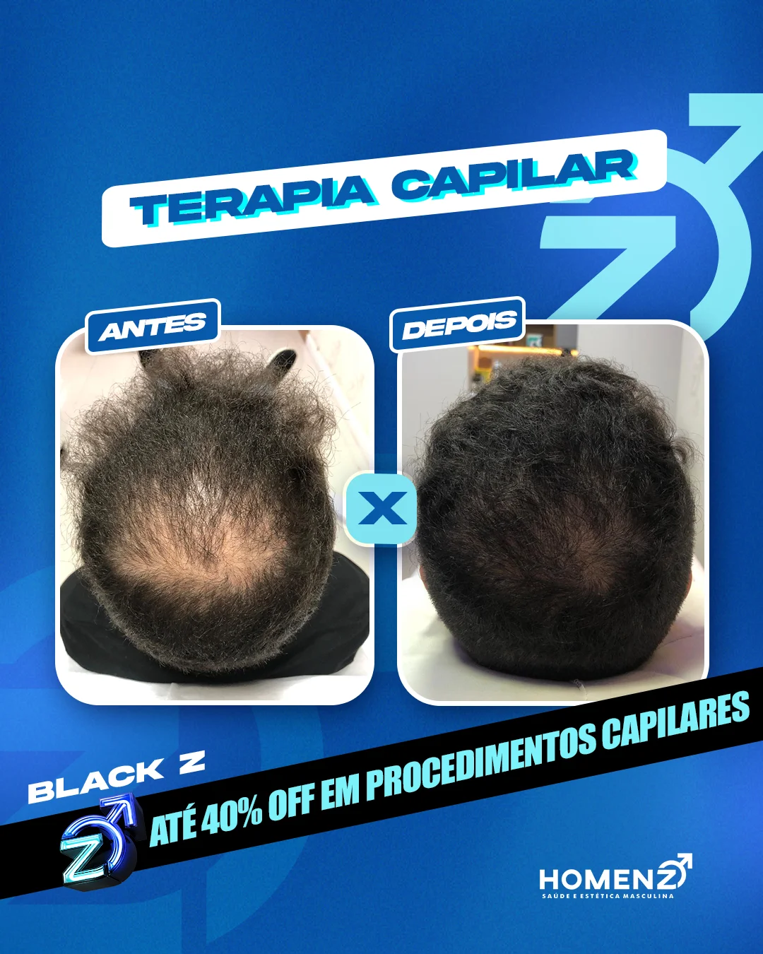 Antes e depois terapia capilar